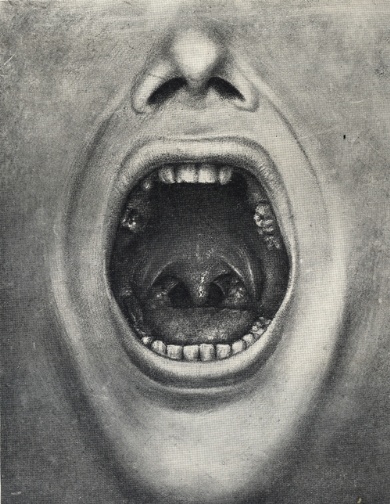 Файл:Illustration from The Defective Delinquent and Insane.jpg