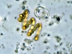 Anabaenaspiroides EPA.jpg