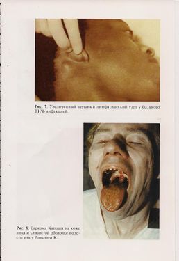 AIDS20.jpg