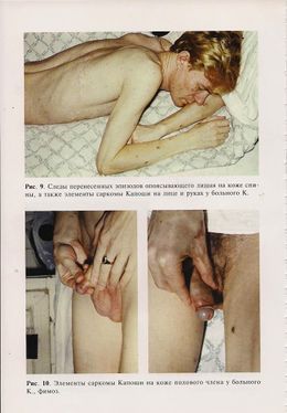 AIDS21.jpg